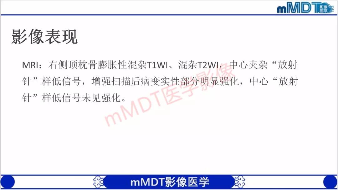 【PPT】颅骨“放射样”骨针的影像诊断