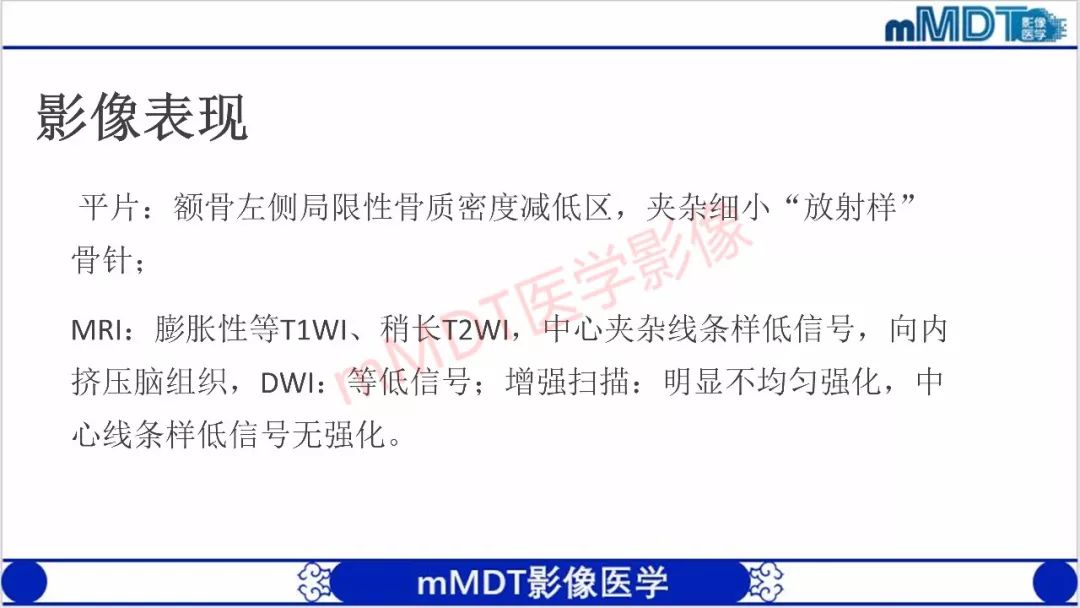 【PPT】颅骨“放射样”骨针的影像诊断