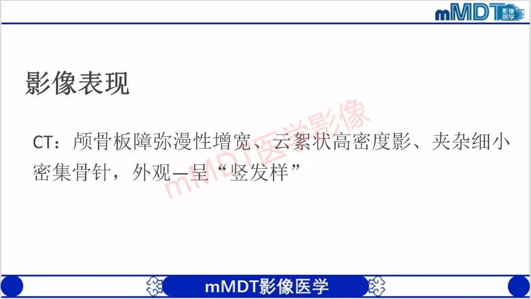 【PPT】颅骨“放射样”骨针的影像诊断