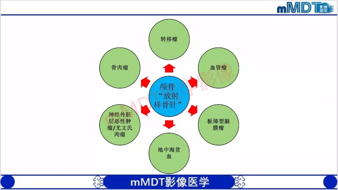 【PPT】颅骨“放射样”骨针的影像诊断