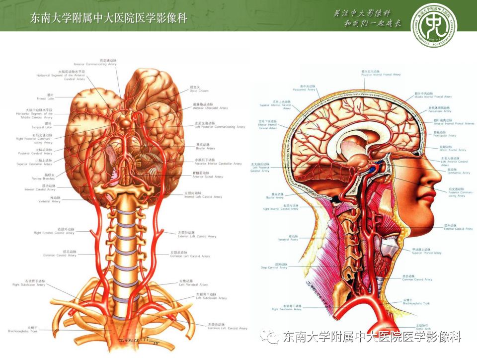 【病例】永存三叉动脉2例MRA