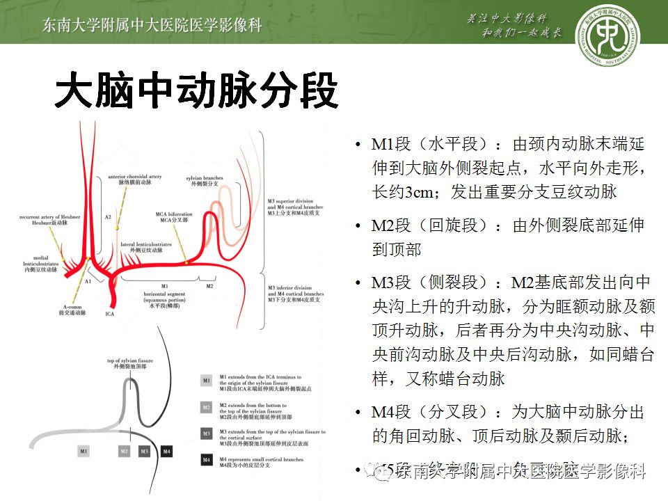 【病例】永存三叉动脉2例MRA