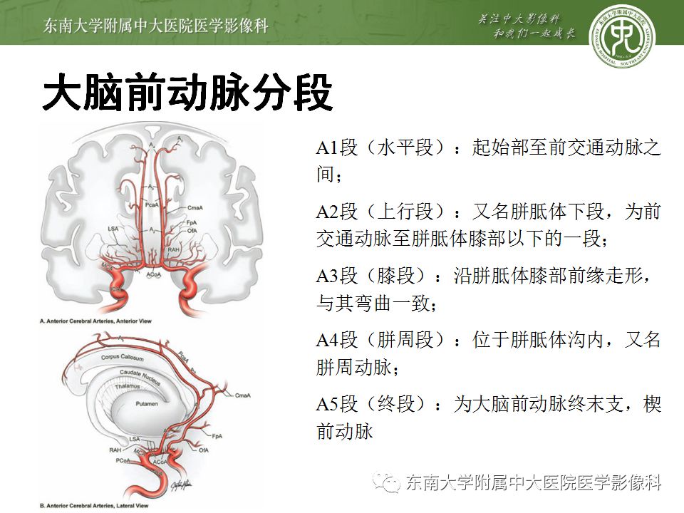 【病例】永存三叉动脉2例MRA