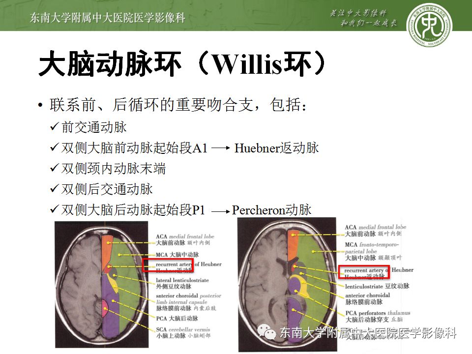 【病例】永存三叉动脉2例MRA