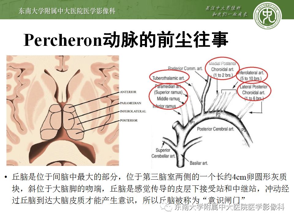 【病例】永存三叉动脉2例MRA