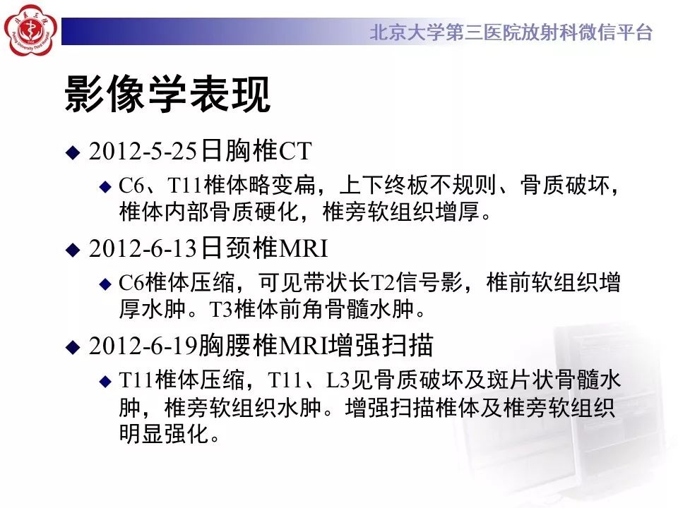 【病例】慢性复发性多灶性骨髓炎1例X线CT及MR