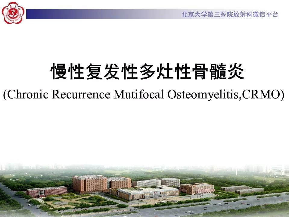 【病例】慢性复发性多灶性骨髓炎1例X线CT及MR