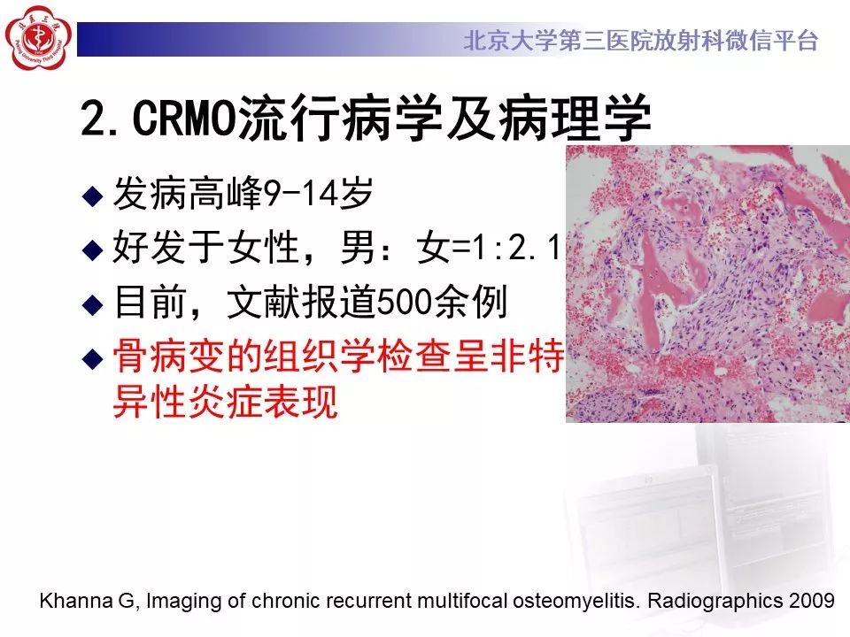 【病例】慢性复发性多灶性骨髓炎1例X线CT及MR