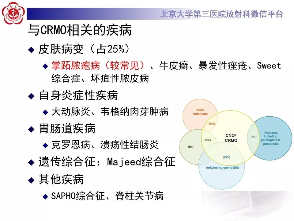 【病例】慢性复发性多灶性骨髓炎1例X线CT及MR