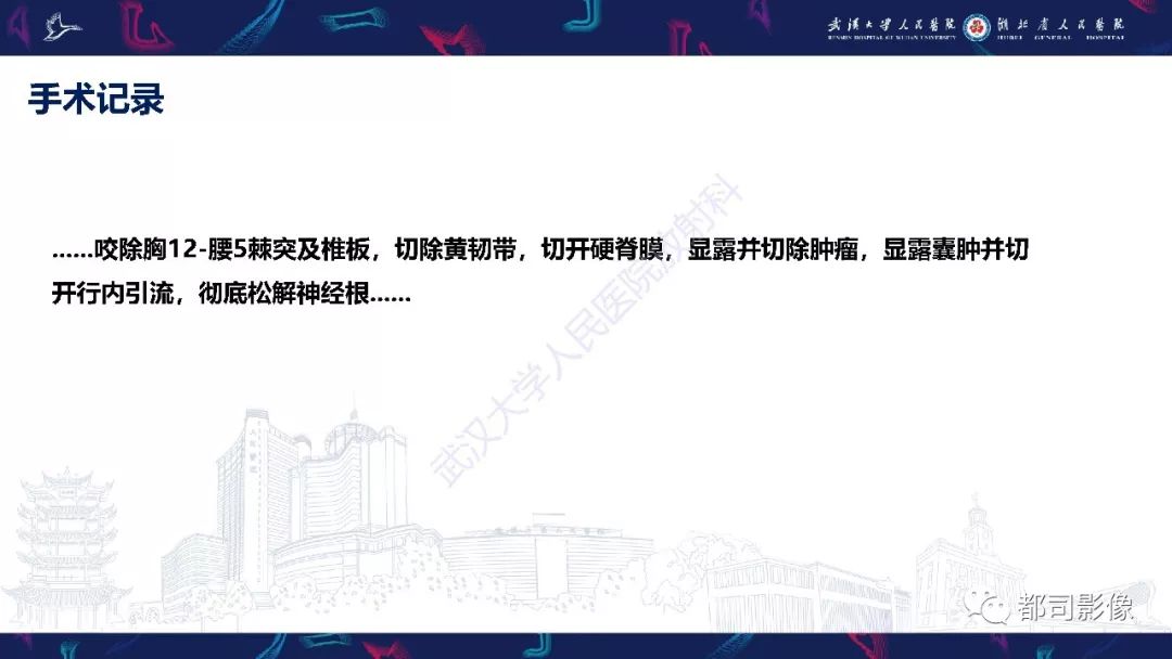 【病例】少见脊膜瘤影像诊断
