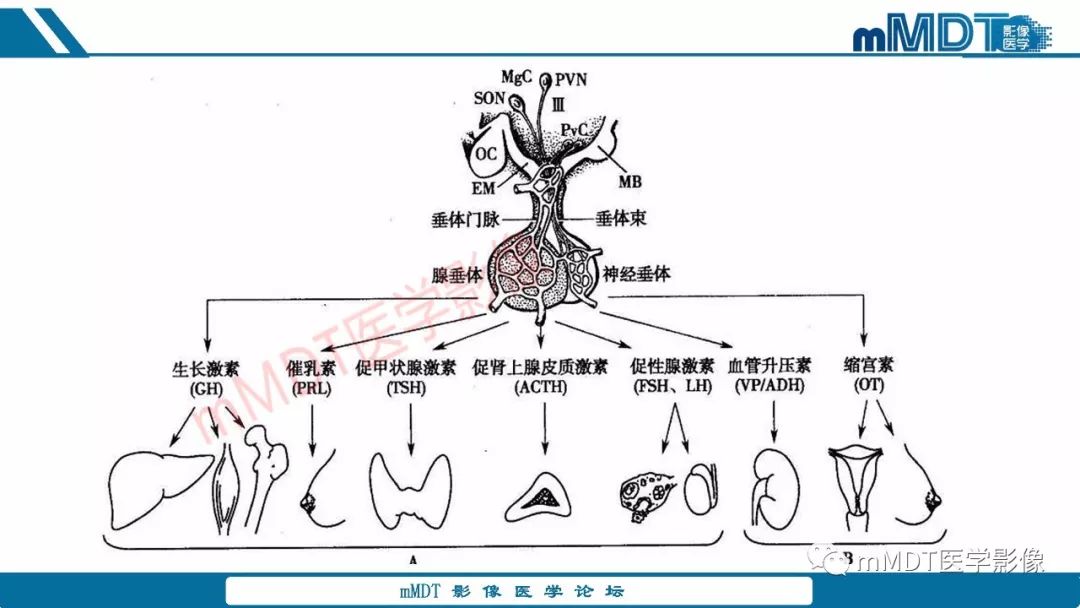 【PPT】蝶鞍、鞍上少见实性肿瘤影像表现及鉴别诊断