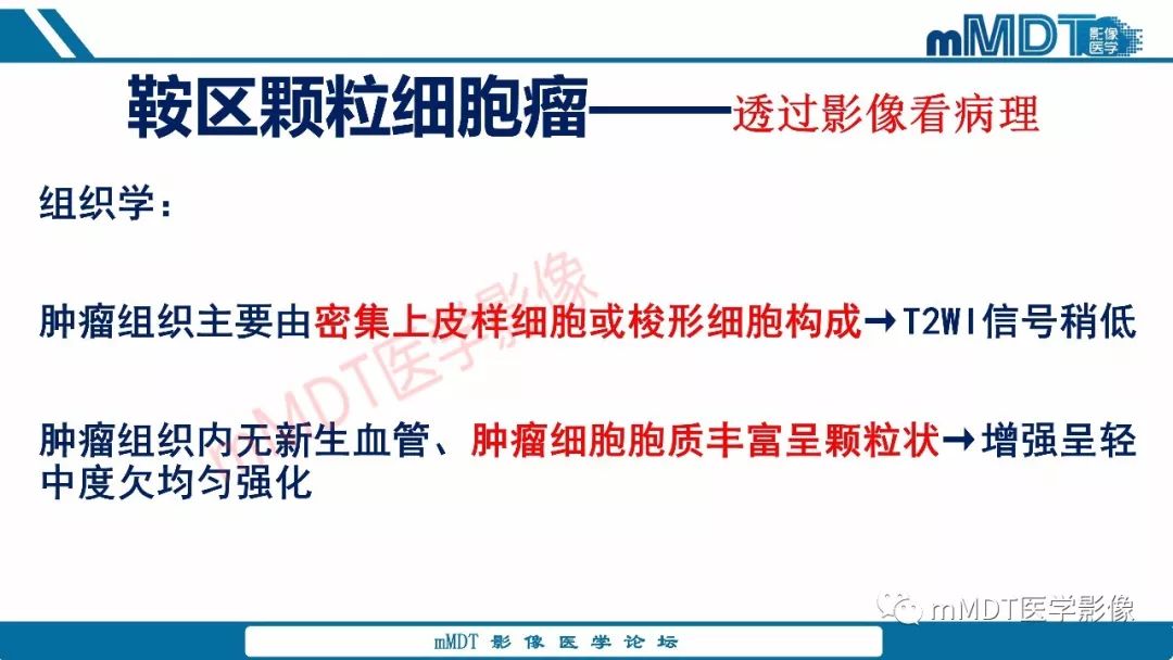 【PPT】蝶鞍、鞍上少见实性肿瘤影像表现及鉴别诊断