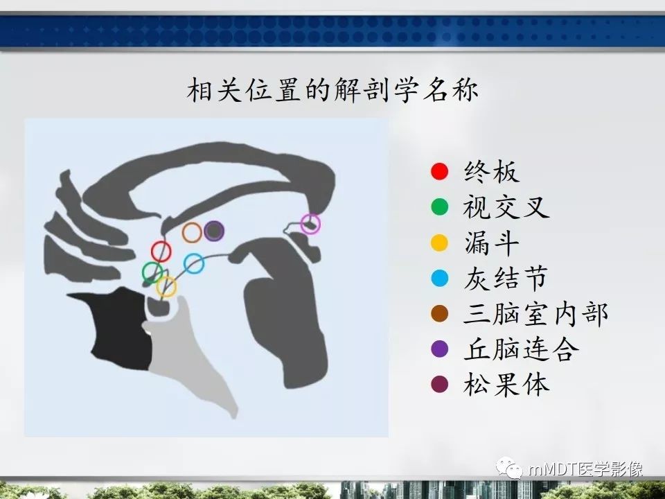 【PPT】三脑室肿瘤影像诊断与鉴别诊断
