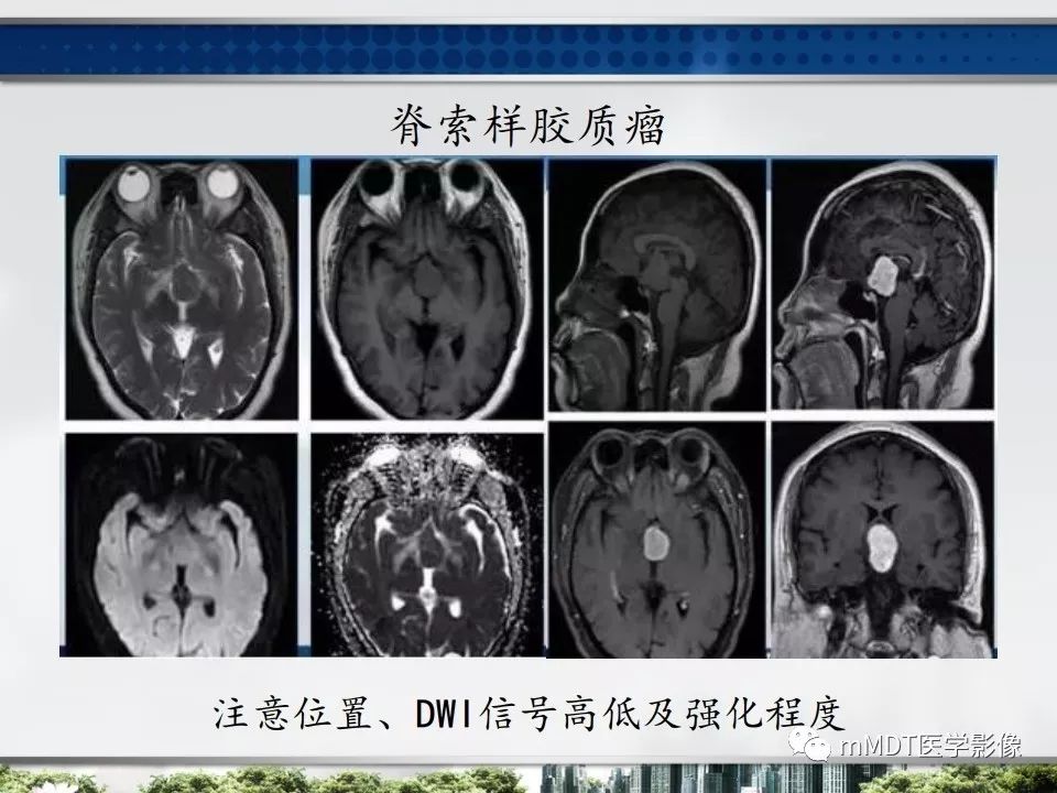 【PPT】三脑室肿瘤影像诊断与鉴别诊断