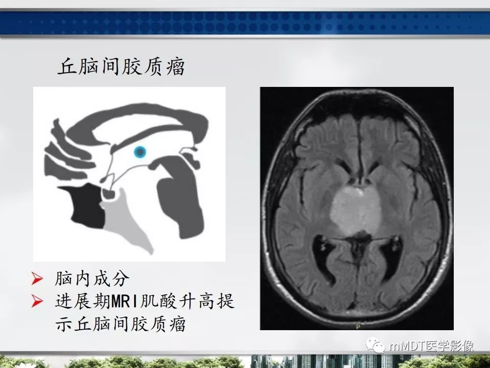 【PPT】三脑室肿瘤影像诊断与鉴别诊断