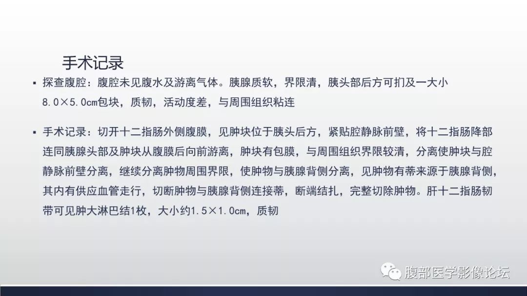 【病例】腹膜后巨淋巴结增生症1例CT影像表现 【病例】腹膜后巨淋巴结增生症1例CT影像表现