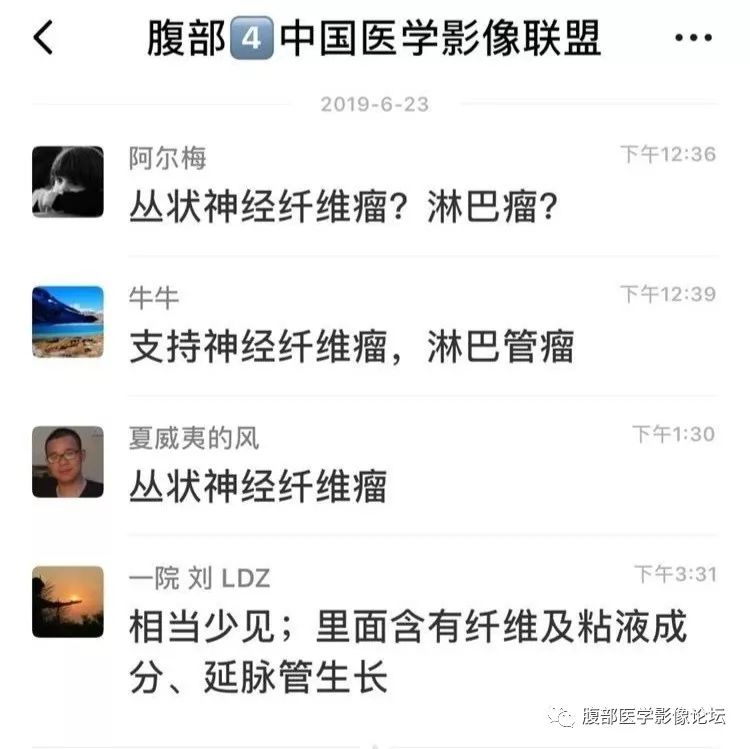 【病例】丛状神经纤维瘤病1例CT及MR