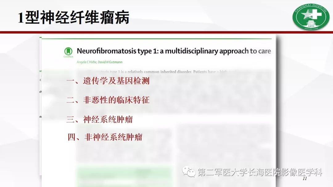 【病例】I型神经纤维瘤病及其相关肿瘤的影像学表现