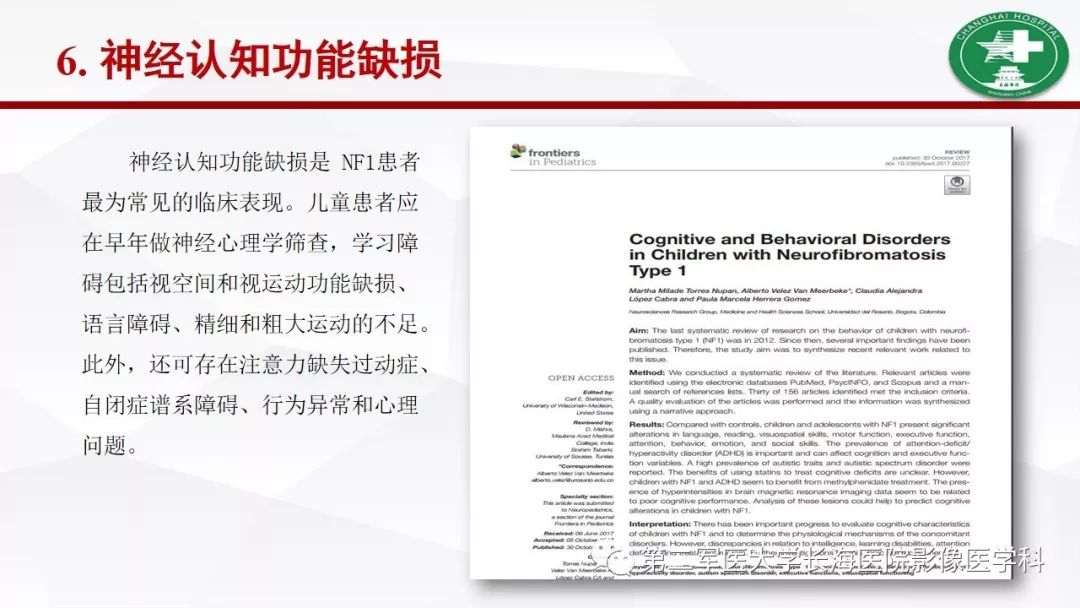 【病例】I型神经纤维瘤病及其相关肿瘤的影像学表现