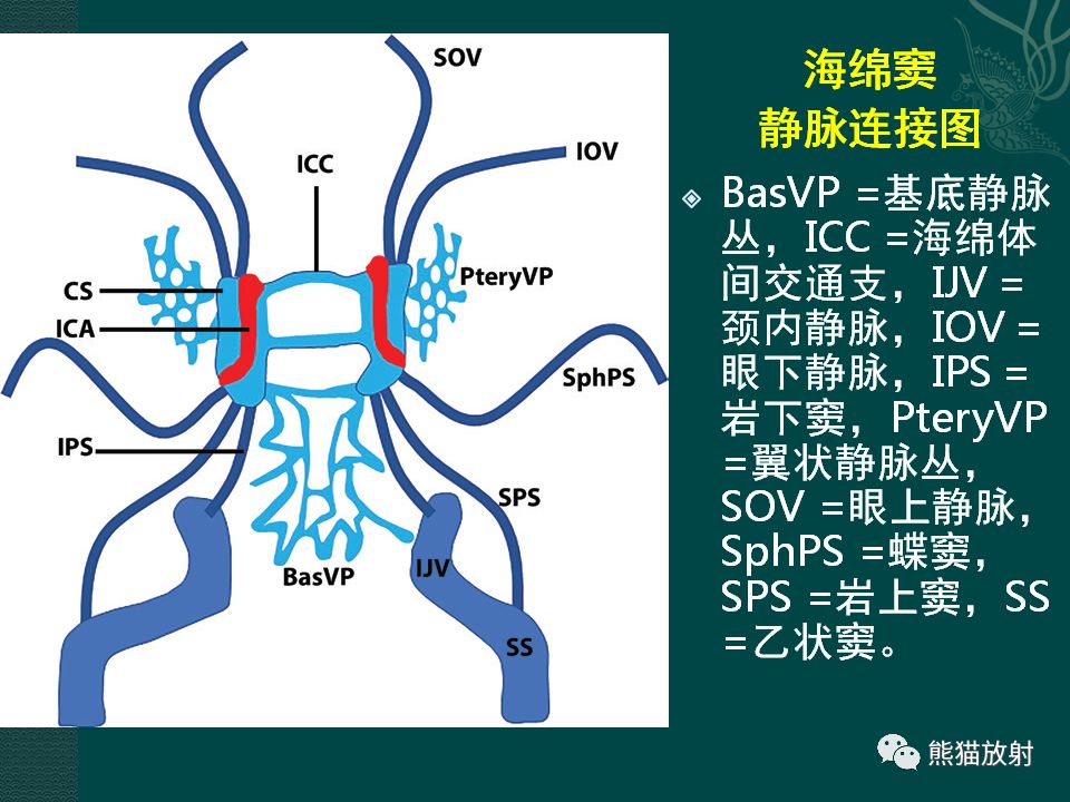 【PPT】海绵窦病变的影像表现及鉴别诊断