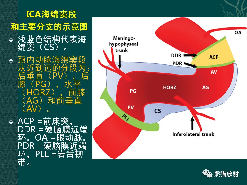 【PPT】海绵窦病变的影像表现及鉴别诊断