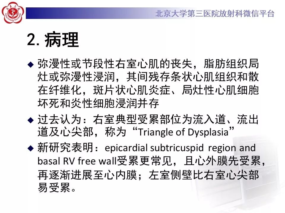 【病例】致心律失常性右室心肌病