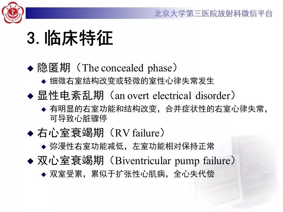 【病例】致心律失常性右室心肌病