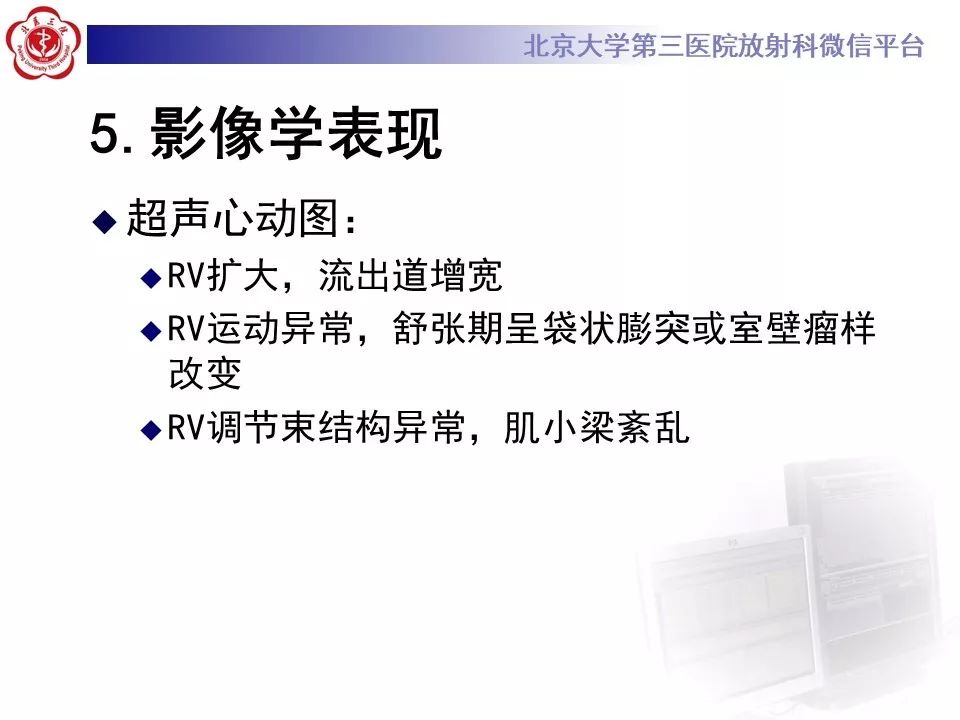 【病例】致心律失常性右室心肌病
