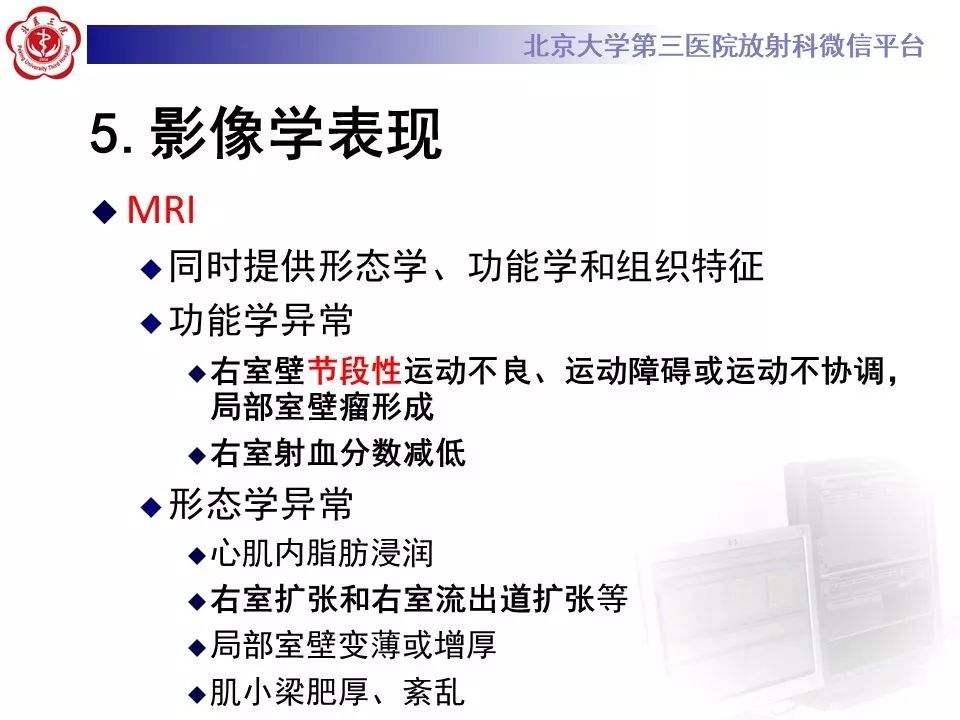 【病例】致心律失常性右室心肌病