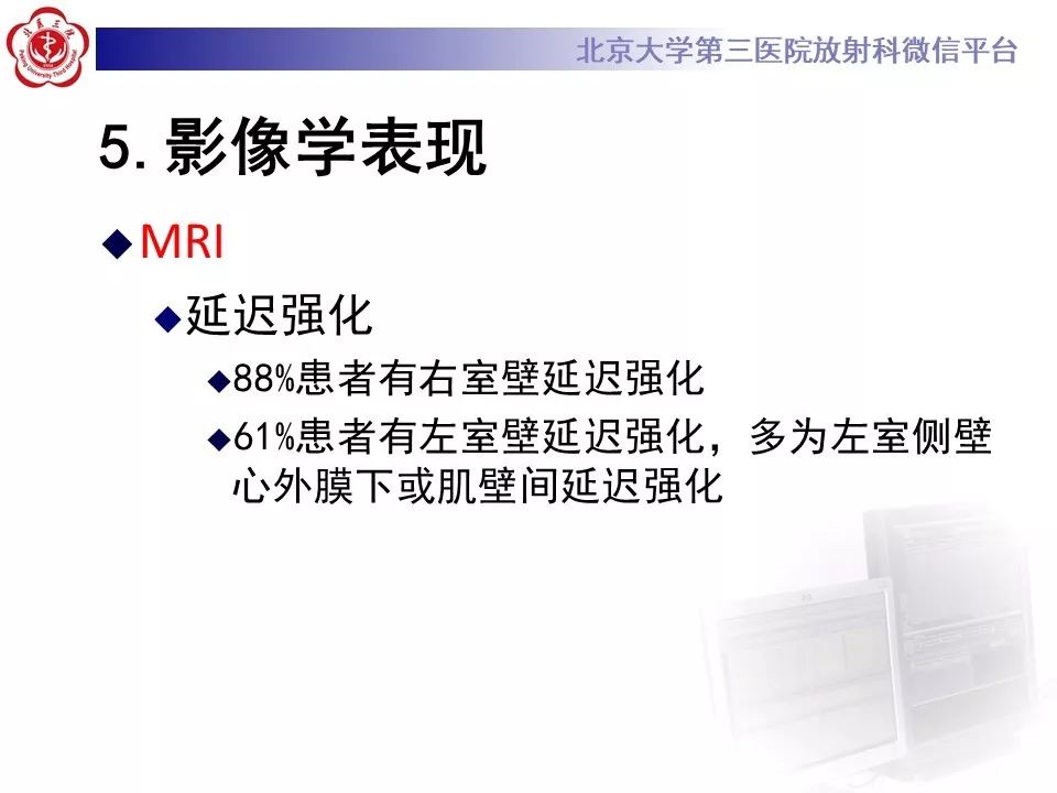 【病例】致心律失常性右室心肌病