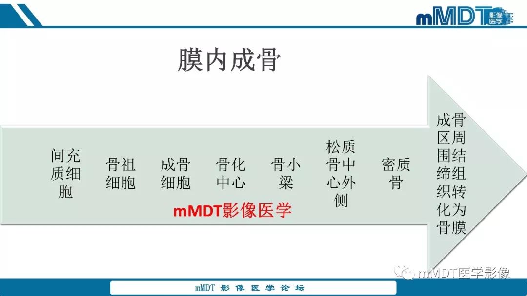 【PPT】成软骨性骨肿瘤影像诊断