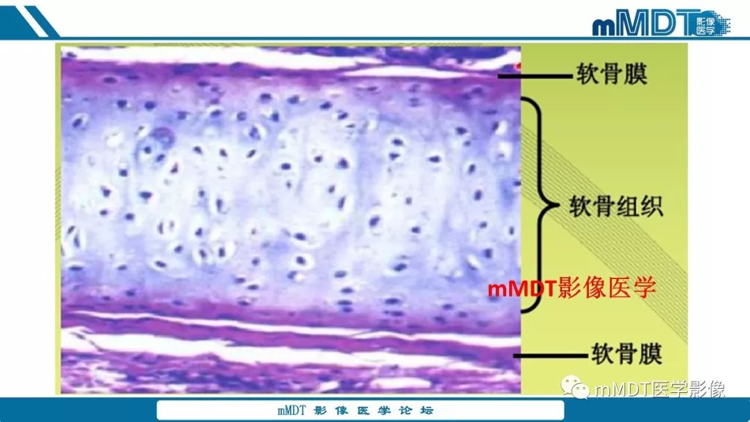 【PPT】成软骨性骨肿瘤影像诊断