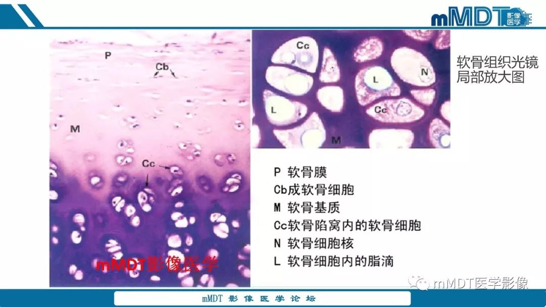 【PPT】成软骨性骨肿瘤影像诊断