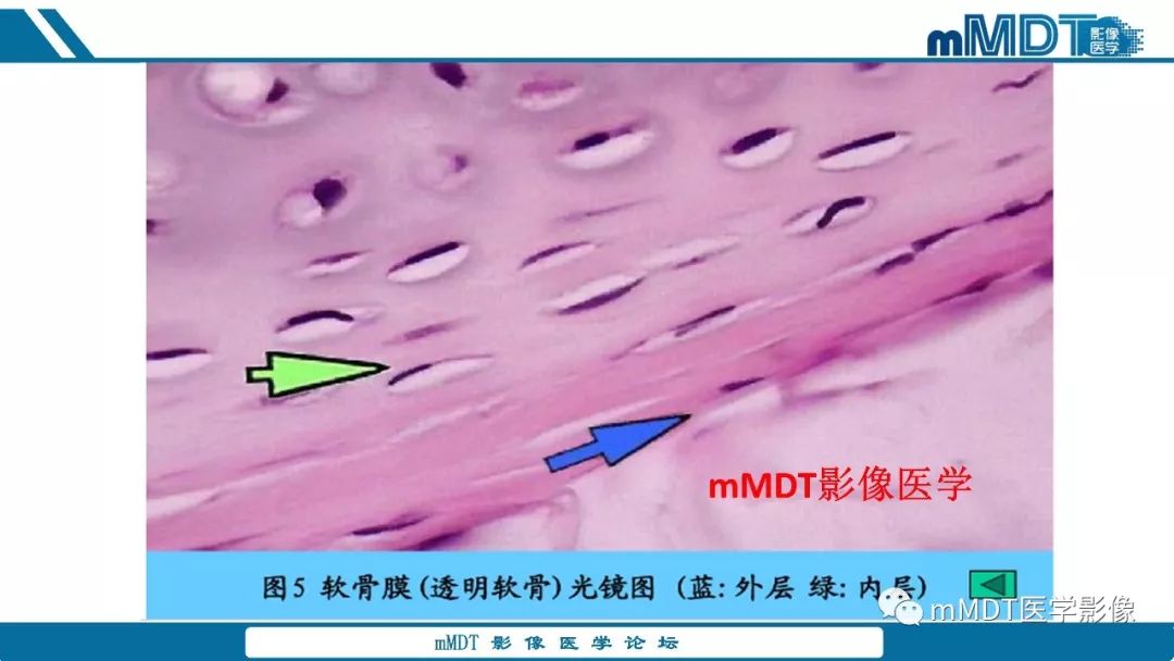 【PPT】成软骨性骨肿瘤影像诊断