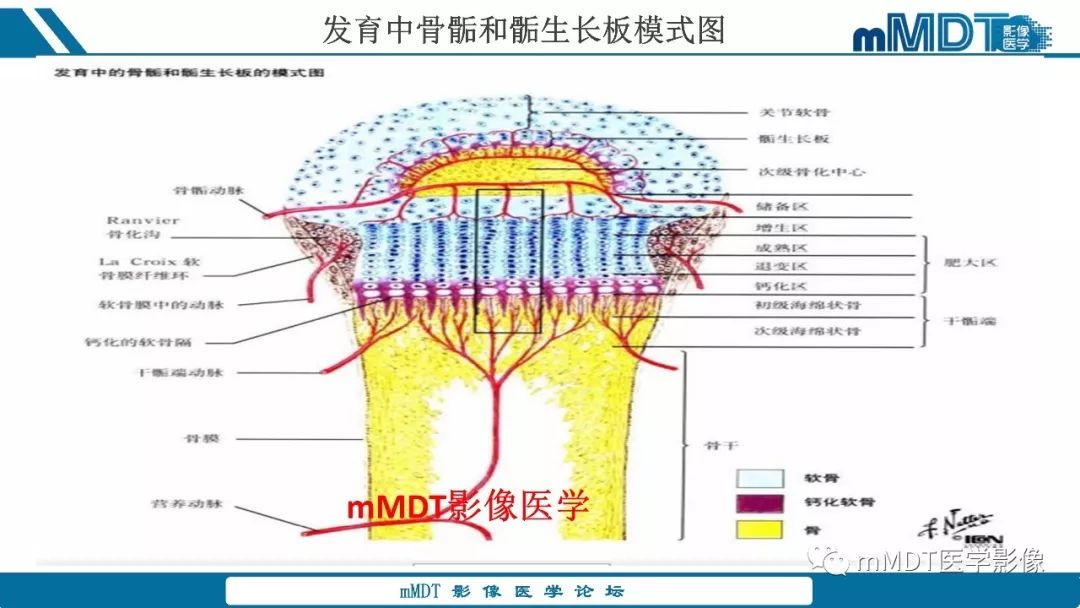 【PPT】成软骨性骨肿瘤影像诊断
