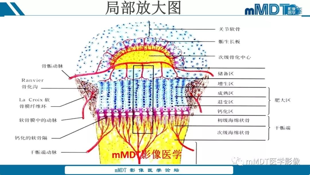 【PPT】成软骨性骨肿瘤影像诊断