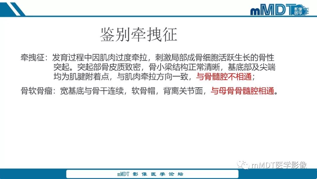 【PPT】成软骨性骨肿瘤影像诊断