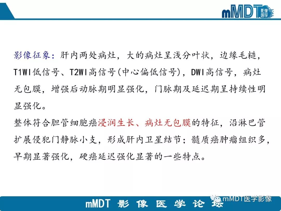 【病例】明显强化的肝内胆管细胞癌1例