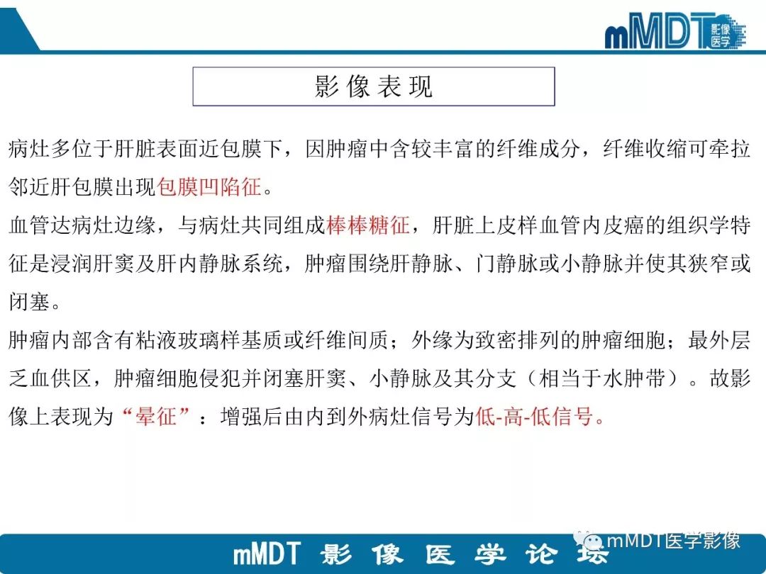 【病例】明显强化的肝内胆管细胞癌1例