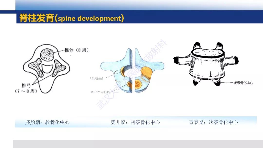 【PPT】先天性椎体畸形影像诊断