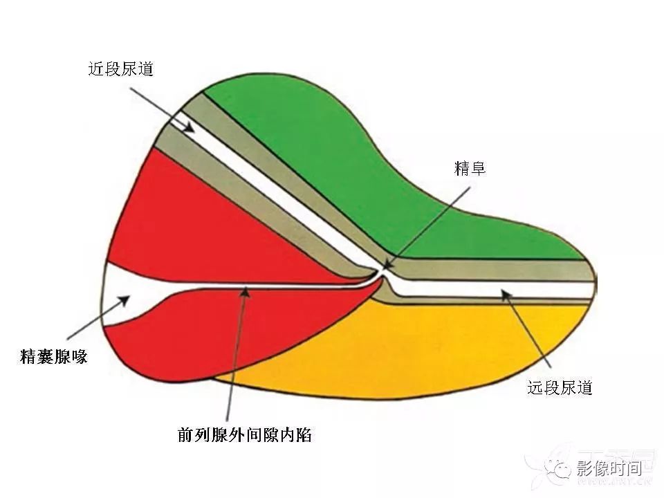 【PPT】前列腺影像解剖与功能解析