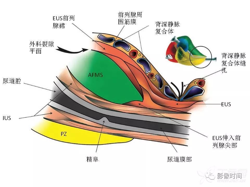 【PPT】前列腺影像解剖与功能解析