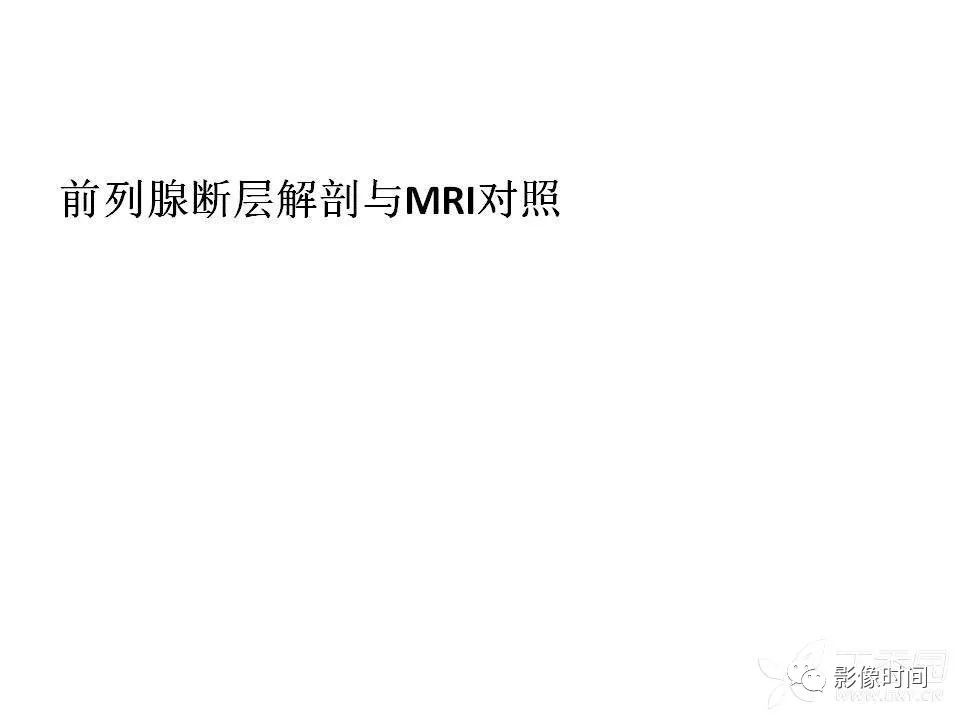 【PPT】前列腺影像解剖与功能解析