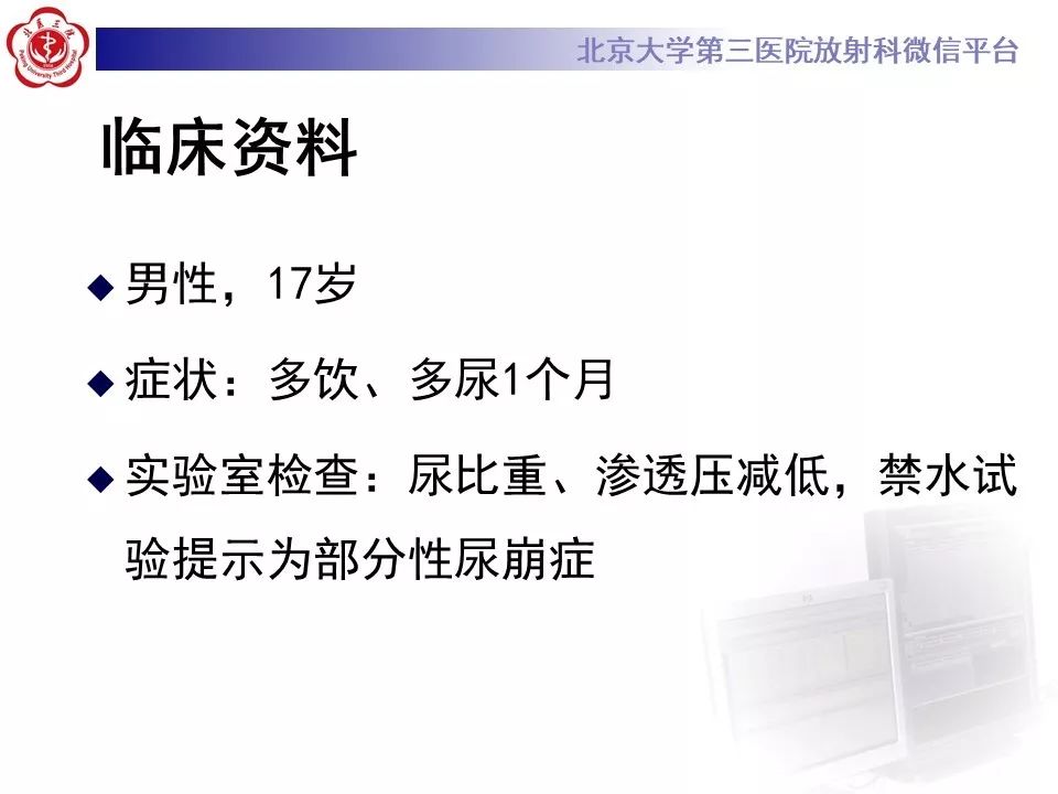 【病例】淋巴细胞性垂体炎2例MR