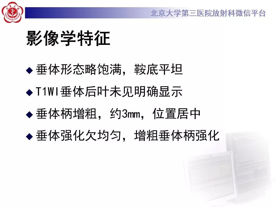 【病例】淋巴细胞性垂体炎2例MR