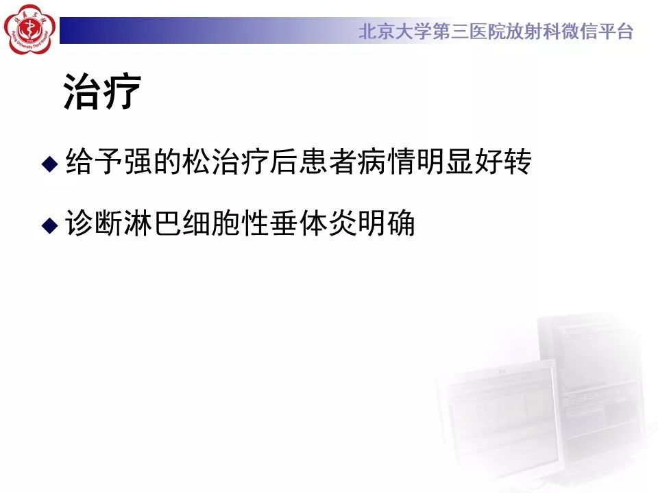 【病例】淋巴细胞性垂体炎2例MR