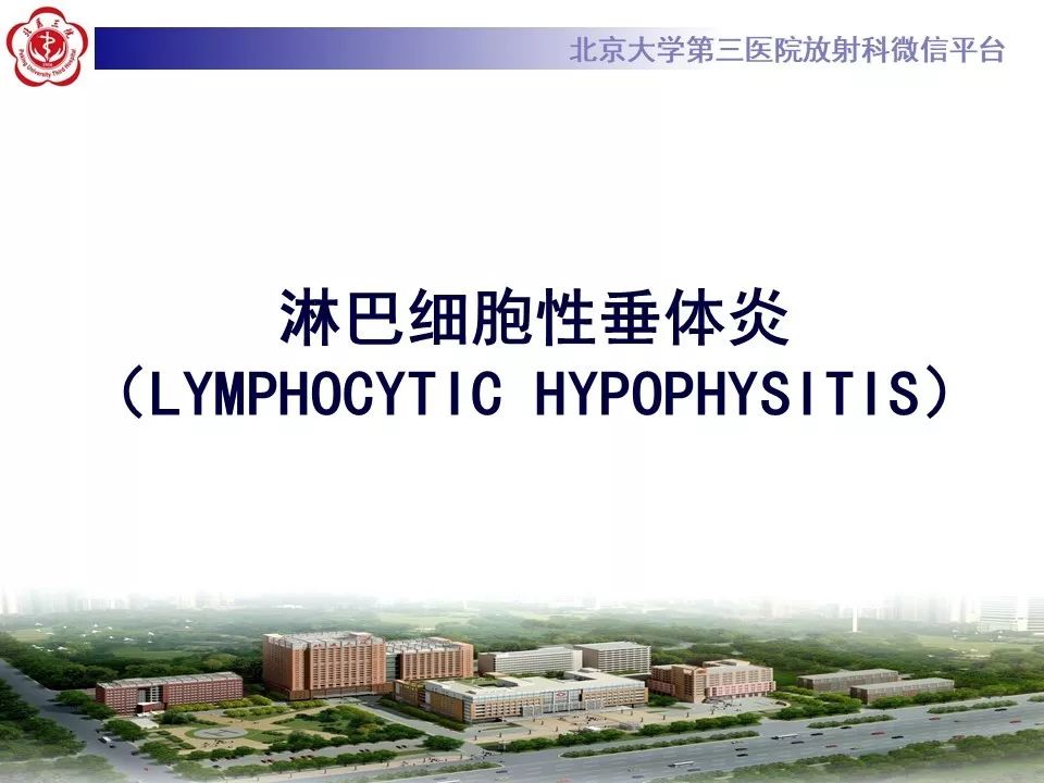 【病例】淋巴细胞性垂体炎2例MR