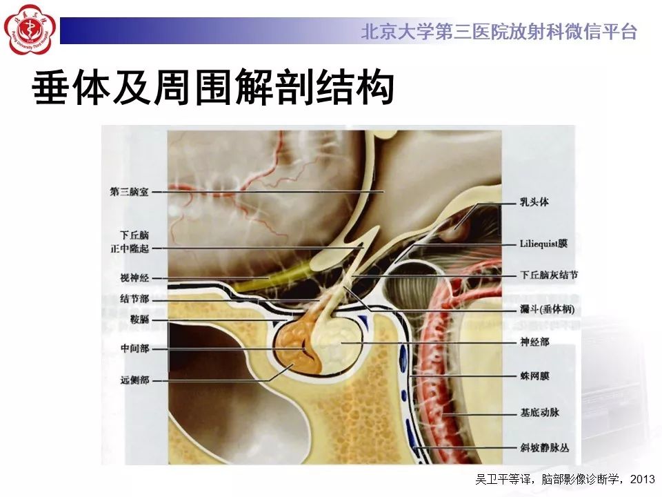 【病例】淋巴细胞性垂体炎2例MR