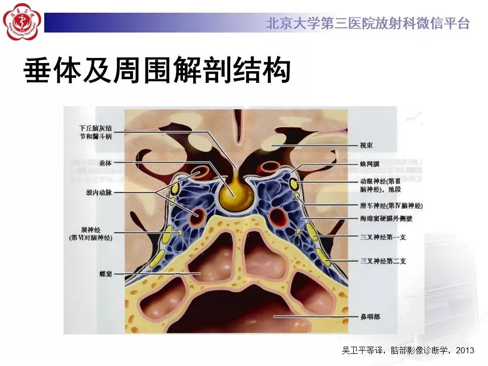 【病例】淋巴细胞性垂体炎2例MR