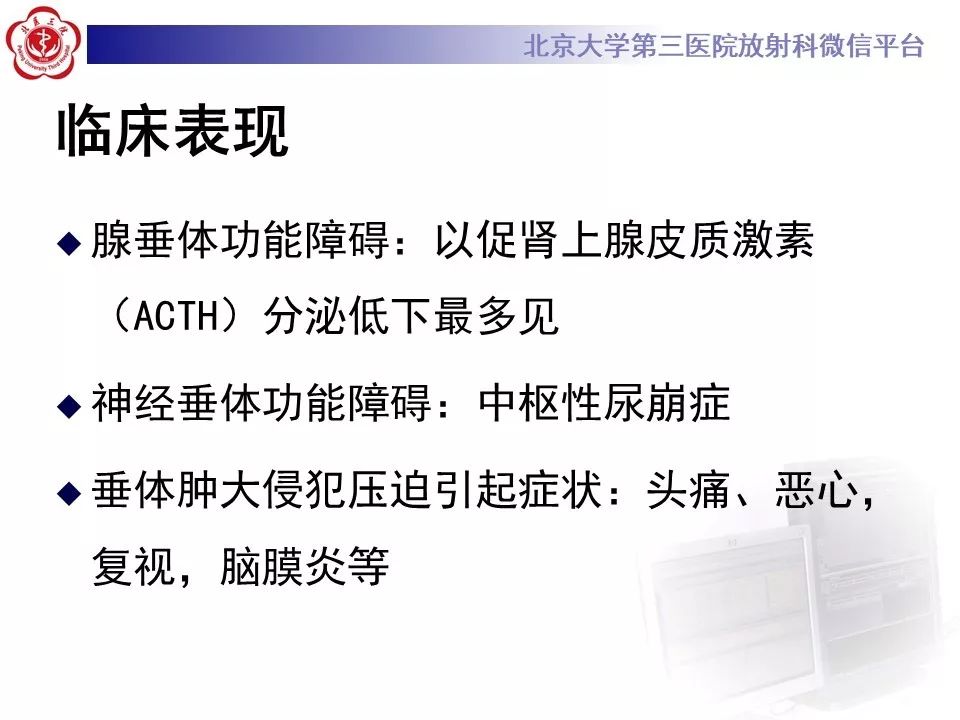 【病例】淋巴细胞性垂体炎2例MR